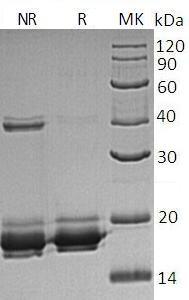 Human GGACT/A2LD1 (His tag) recombinant protein