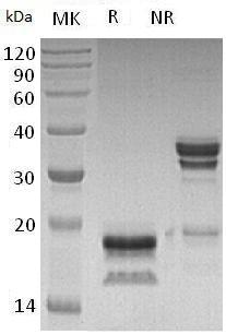 Human IL17A/CTLA8/IL17 (His tag) recombinant protein