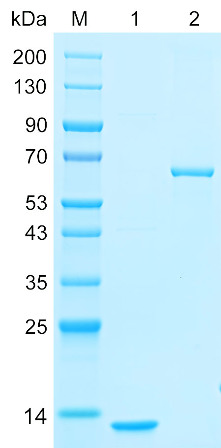 Recombinant VATF protein (His tag) SDS-PAGE