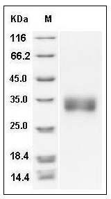 Rat Sclerostin / SOST Protein (His Tag) SDS-PAGE