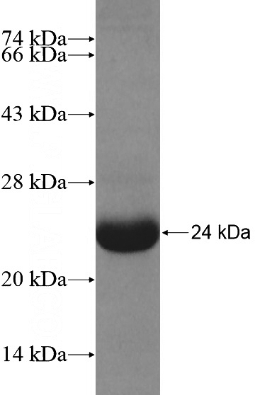 Recombinant Human ABCC3 SDS-PAGE