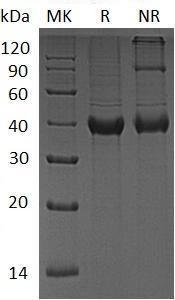 Human B4GALT4/UNQ552/PRO1109 (His tag) recombinant protein
