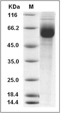 Human GPR114 Protein (Fc Tag) SDS-PAGE