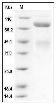 Human c-MET / HGFR Protein (His Tag) SDS-PAGE