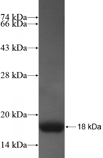 Recombinant Human HOXA7 SDS-PAGE