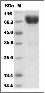 Rat IL10RB / IL10R2 Protein (Fc Tag) SDS-PAGE