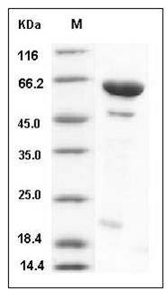 Human DUSP14 / MKP-6 Protein (His & MBP Tag) SDS-PAGE