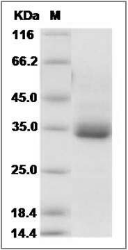 Mouse Syndecan-4 / SDC4 Protein (Fc Tag) SDS-PAGE