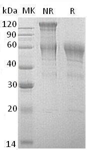 Human SPESP1/UNQ732/PRO1418 (His tag) recombinant protein