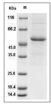 Human Interferon alpha 7 / IFNA7 Protein (Fc Tag) SDS-PAGE