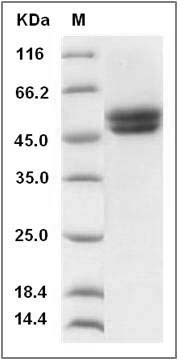Human AGER / RAGE Protein (His Tag) SDS-PAGE