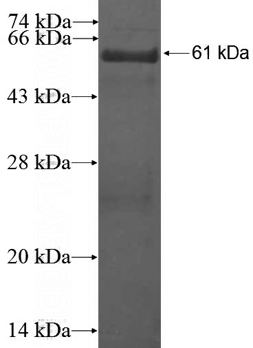 Recombinant Human GNAO1 SDS-PAGE