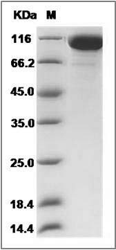 Rat Semaphorin 4D / SEMA4D / CD100 Protein (His Tag) SDS-PAGE