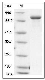 Mouse Transferrin Receptor / TFRC / CD71 Protein (His Tag) SDS-PAGE