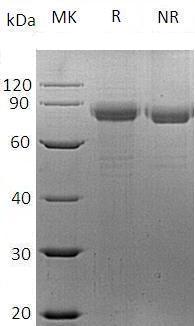Human SH3KBP1/CIN85 (His tag) recombinant protein