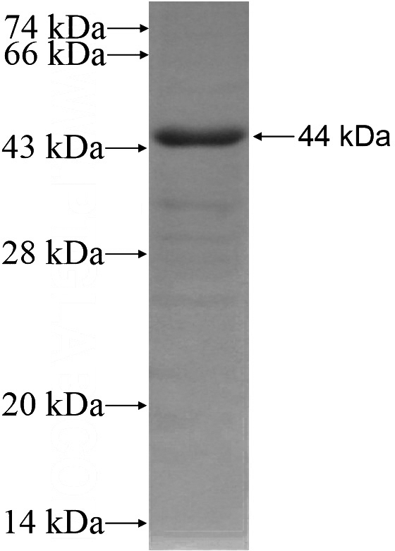 Recombinant Human FAM62A SDS-PAGE
