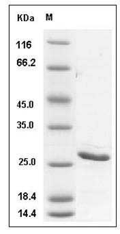Human BCL2 / Bcl-2 Protein (His Tag) SDS-PAGE