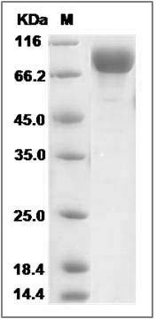 Rat MSR1 / SCARA1 Protein (Fc Tag) SDS-PAGE