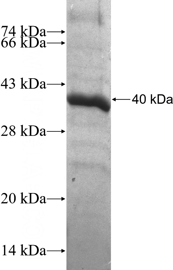 Recombinant Human RIMKLB SDS-PAGE