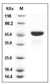 Human SOCS3 / CIS3 Protein (His & Trx Tag) SDS-PAGE