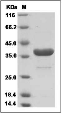Human TP53I3 / PIG3 Protein (His Tag) SDS-PAGE