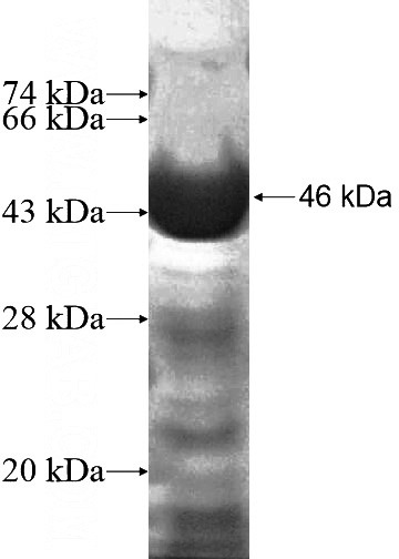 Recombinant Human PCDHA4 SDS-PAGE