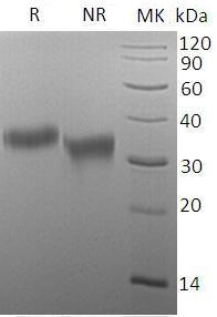 Human FOLR1/FOLR (His tag) recombinant protein
