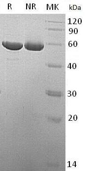 Human RTBDN (His tag) recombinant protein