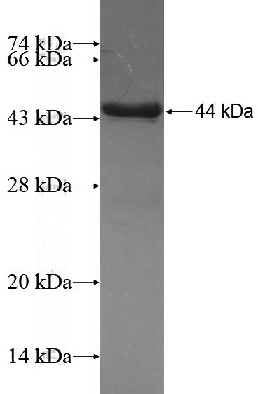 Recombinant Human LPL SDS-PAGE