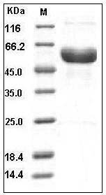 Human Fetuin-A / AHSG / FETUA Protein (His Tag) SDS-PAGE