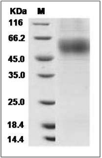 Rat MSR1 / SCARA1 Protein (His Tag) SDS-PAGE