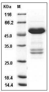 Human TWF1 / PTK9 / Twinfilin-1 Protein (His & GST Tag) SDS-PAGE