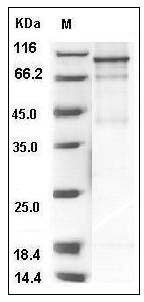 Human FES Kinase / Feline sarcoma oncogene Protein (His & GST Tag) SDS-PAGE