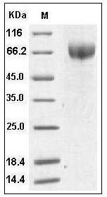 Human IL18BPa Protein (His & Fc Tag) SDS-PAGE