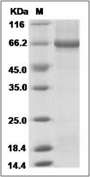 Human Alkaline phosphatase / ALPP Protein (His Tag) SDS-PAGE