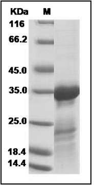 Influenza A H3N2 (A/Aichi/2/1968) Matrix protein 1 / M1 Protein (His Tag) SDS-PAGE