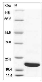 Human CFL2 / cofilin 2 / ADF Protein (His Tag) SDS-PAGE
