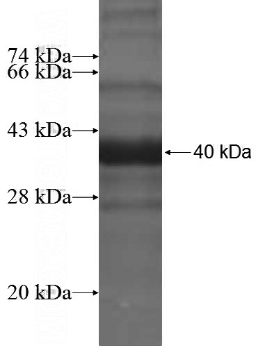 Recombinant Human PTH2R SDS-PAGE