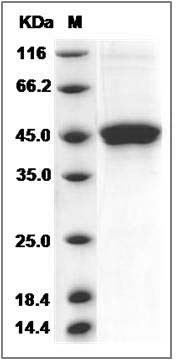 Rat GITR / TNFRSF18 Protein (Fc Tag) SDS-PAGE