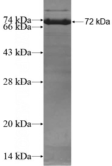 Recombinant Human TULP3 SDS-PAGE