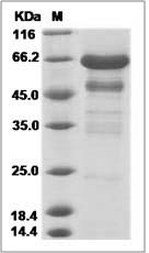 Mouse IGFBP-2 / IGFBP2 Protein (Fc Tag)