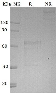 Human IL20RB/DIRS1/UNQ557/PRO1114 (Fc tag) recombinant protein