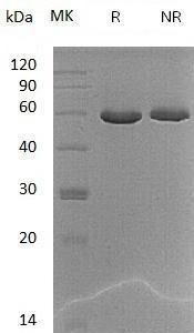 Mouse Cpq/Hls2/Pgcp (His tag) recombinant protein