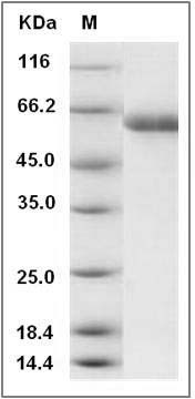 Human sialate O-acetylesterase / SIAE Protein (His Tag) SDS-PAGE