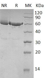 Human KPNA2/RCH1/SRP1 (His tag) recombinant protein