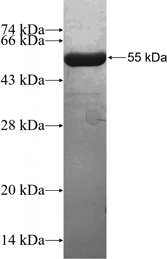 Recombinant Human HORMAD1 SDS-PAGE