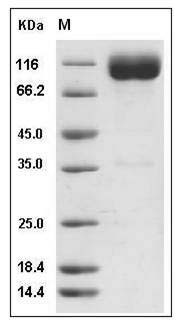 Rat IL18R1 Protein (Fc Tag) SDS-PAGE