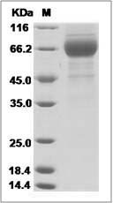 Influenza A H3N2 (A/Philippines/472/2002) (MDCK) Hemagglutinin / HA1 Protein (His Tag)