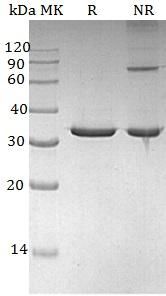Human SULT4A1/SULTX3 recombinant protein