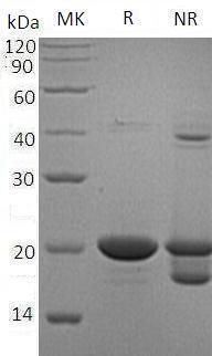 Human NME1/NDPKA/NM23 (His tag) recombinant protein